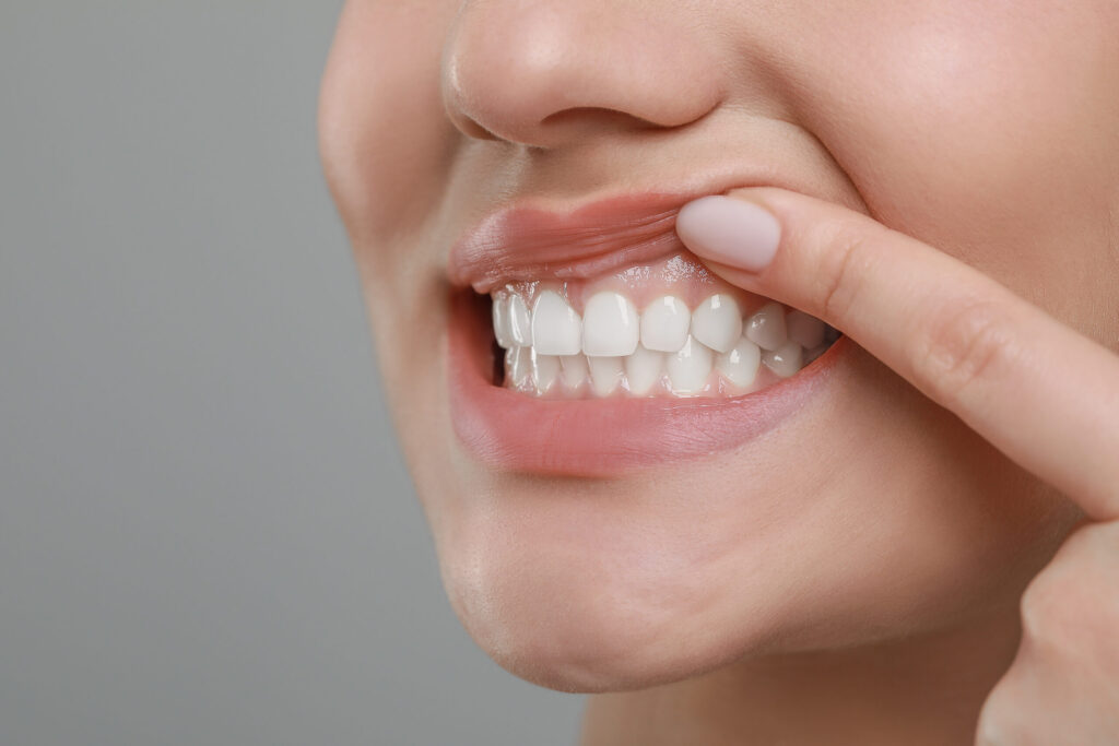 Fairport, NY, dentist offers treatments for periodontal disease