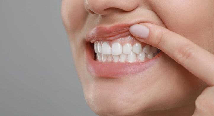 Tooth Loss Caused By Periodontal Disease